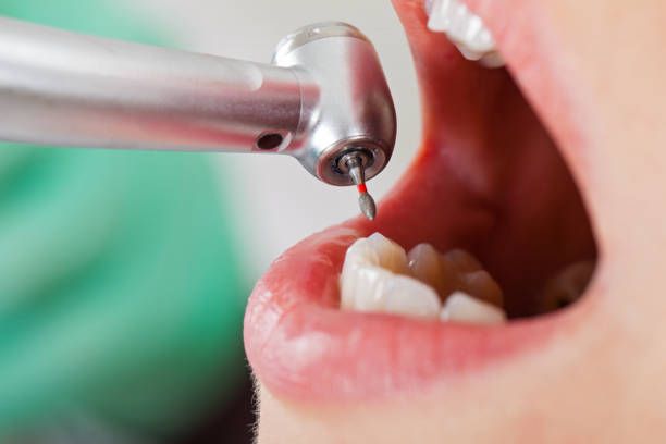 Best Pediatric Emergency Dentist in Emerald Lake Hills, CA